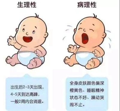 新生儿高胆红素血症:科学应对,守护宝宝健康成长(图2) 新生儿高胆红素血症:科学应对,守护宝宝健康成长(图2)
